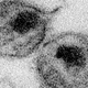 An electron microscope image of HIV particles.